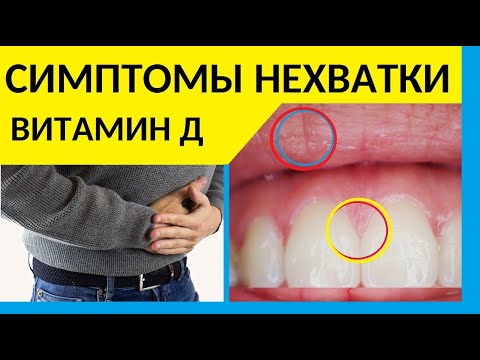 Дефицит витамина Д. Чем опасен для организма дефицит витамина Д