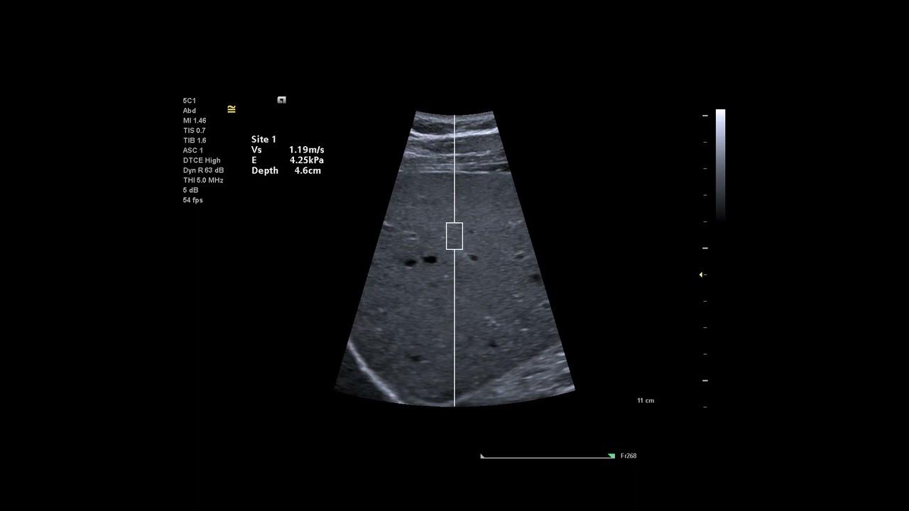 Siemens Juniper is the ultrasound cover 19 transducers to expand