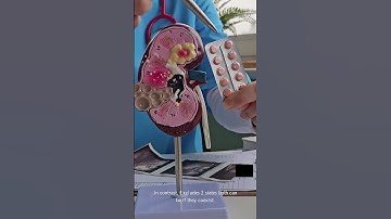 Medical Coding ICD 10 CM Excludes 2