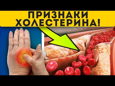 Вопрос: Как понизить уровень триглицеридов?