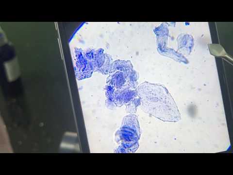 Video Tế bào niêm mạc miệng và vi khuẩn khoang miệng ở người... - youtube