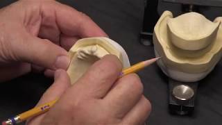 Setting Mondial Teeth: Ch. 1  Model Analysis