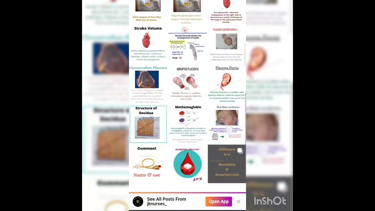 (Follow jknurses) Short video for nursing students 😊