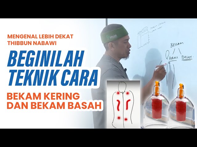 MENGENAL LEBIH DEKAT THIBBUN NABAWI -   BEGINILAH TEKNIK CARA BEKAM KERING & BEKAM BASH ! class=