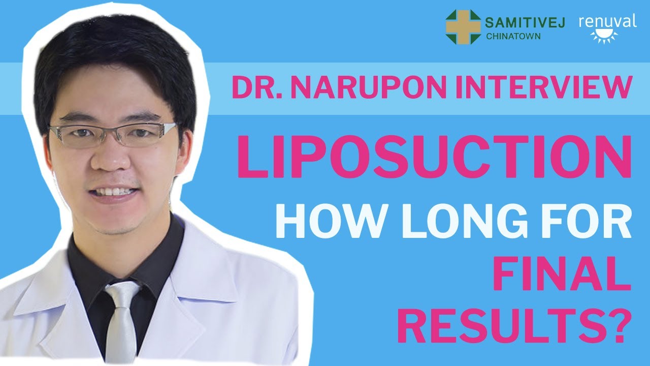 How Long After Will I See The Final Results After Liposuction?