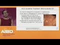Updates on ACG guidelines for the treatment of severe Crohn's disease