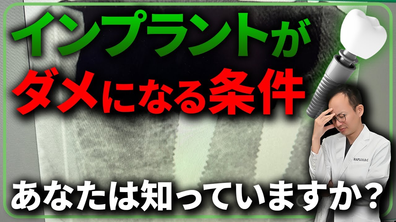 せっかく入れたインプラントが台無しに...？1万本以上のインプラントを入れてきた現役歯科医師が解説します。