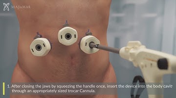 Endoscopic Linear Cutting Stapler and Reloads Instructions For Use by MAJnMAR Medical Products.