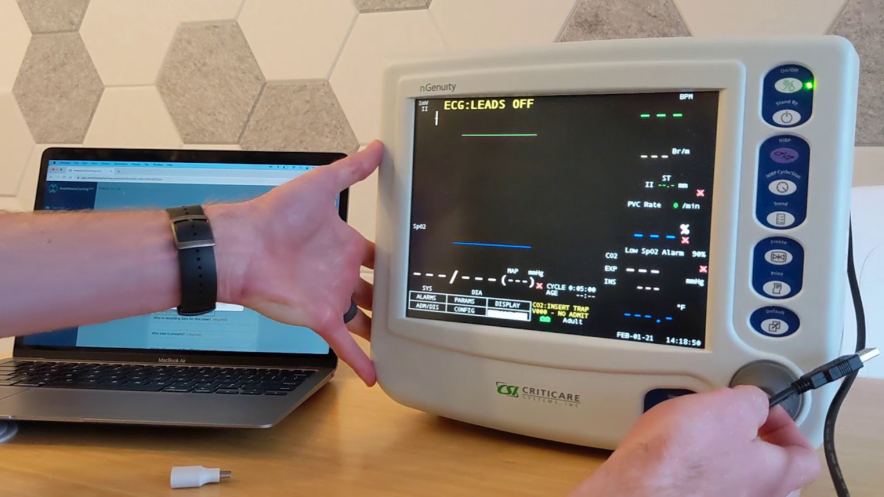 Carta Stampante 57 Mm X 25 M Per Gima-Urilyzer-Rescue 230/Life-Tecno G - Foto 12