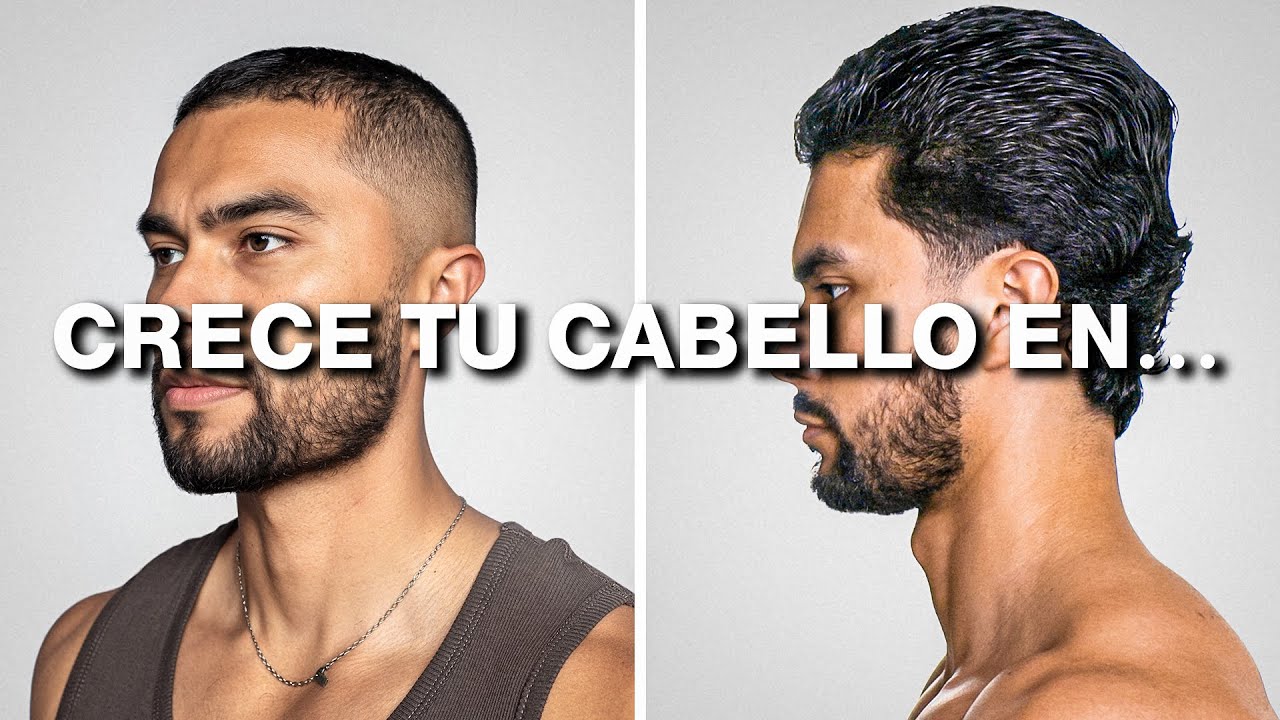 Mira esto antes de tu próximo corte de pelo | Actualización sobre mi trasplante capilar