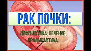 Рак почки: диагностика, профилактика, лечение