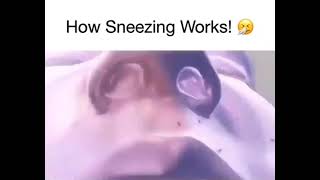 How Sneezing Works Profile