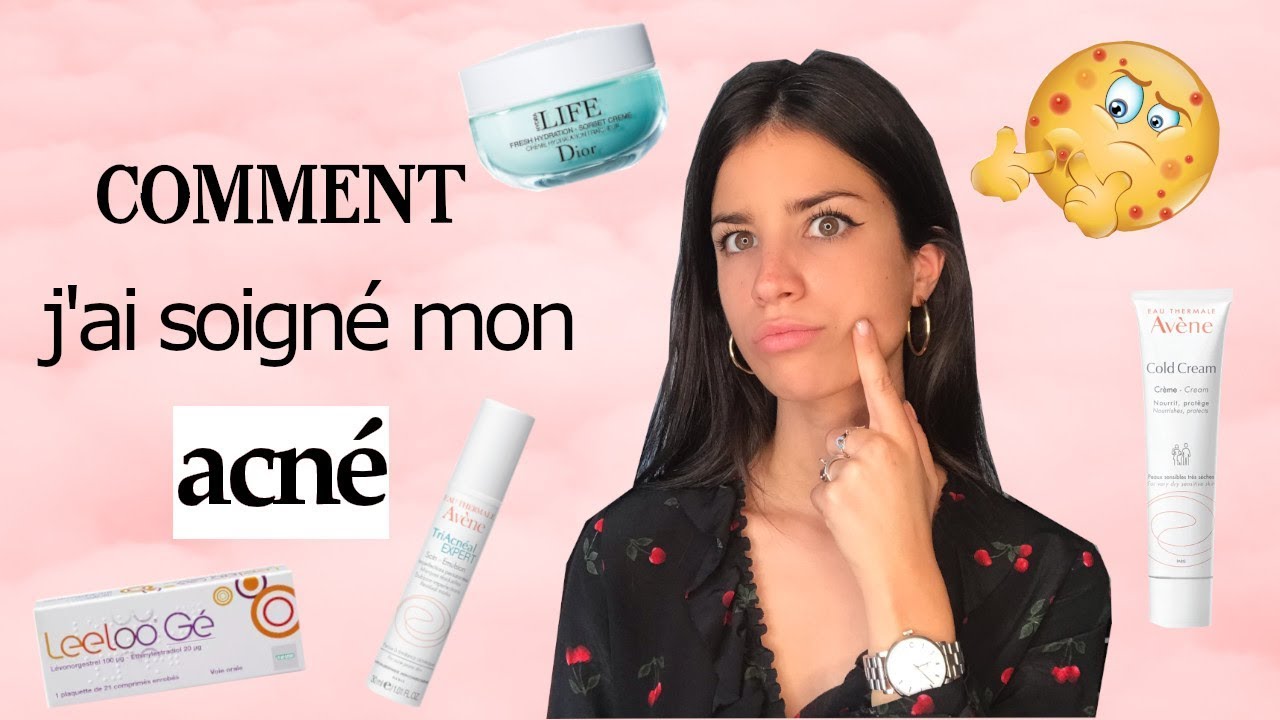 COMMENT J'AI SOIGNÉ MON ACNÉ - Pilule, traitement, causes... JE VOUS DIS  TOUT !