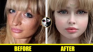 Angelica Kenova - 👧 Barbie Doll Plastic Surgery Before and After 👧 - ( Hot Beautiful Girls )