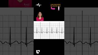 Name This Disorder #85: EKG SHORT | @LevelUpRN