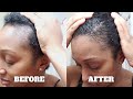 How I Grew My Edges Back Using Wild Growth Hair Oil