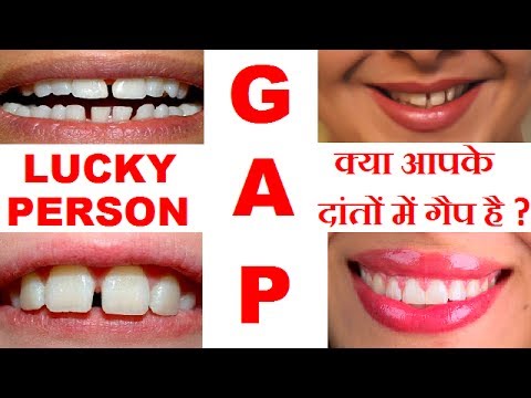 वीडियो: ऊपरी राशि के लक्षण क्या हैं