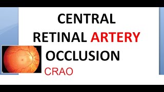 Ophthalmology CRAO Central Retinal Artery Occlusion Cherry Red Spot Cattle Tracking Marcus Gunn