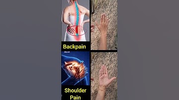 Thumbnail of Powerful Mudras #yoga #mudra #shoulder #backpain #problem #yogapose #ytshorts #viralvideo #trending