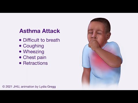 Asthmatic Bronchiole During an Exacerbation