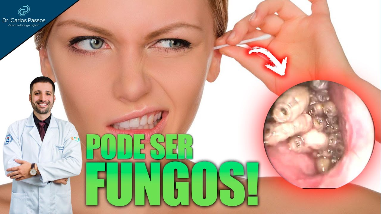 Ouvido COÇANDO? pode ser FUNGOS! - YouTube