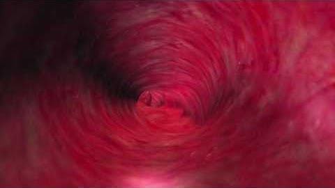 EDWARDS VIGILEO Central Oximetry Catheter