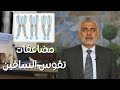 تقوس الساقين ما هي أضرار ومضاعفات تقوس الساقين 