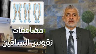 تقوس الساقين: ما هي أضرار ومضاعفات تقوس الساقين ؟