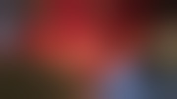 isolated complete resection of the caudate lobe, including the paracaval portion.