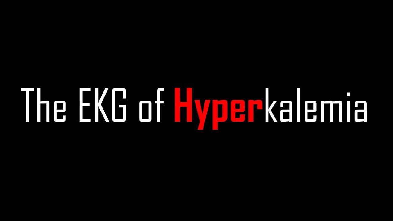 EKG of Hyperkalemia : กลไกพื้นฐาน การอ่าน การรักษา | The Pacemaker