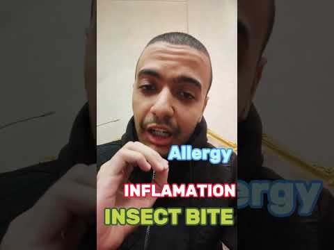 هل جل الصبار مرطب ترطيب البشرة