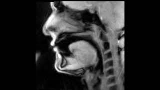 Douglas Yeo, trombone - MRI video 9 - pitch bends