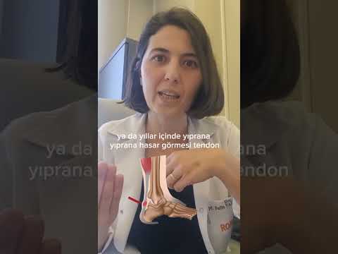 Tendon nedir, tendinit nedir? #sporhekimi #sporcu #sporcusağlığı #antrenman #tendon