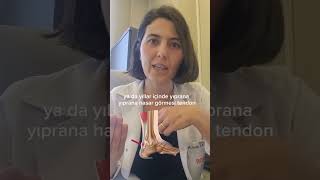 Tendon Nedir, Tendinit Nedir? Ğlığı