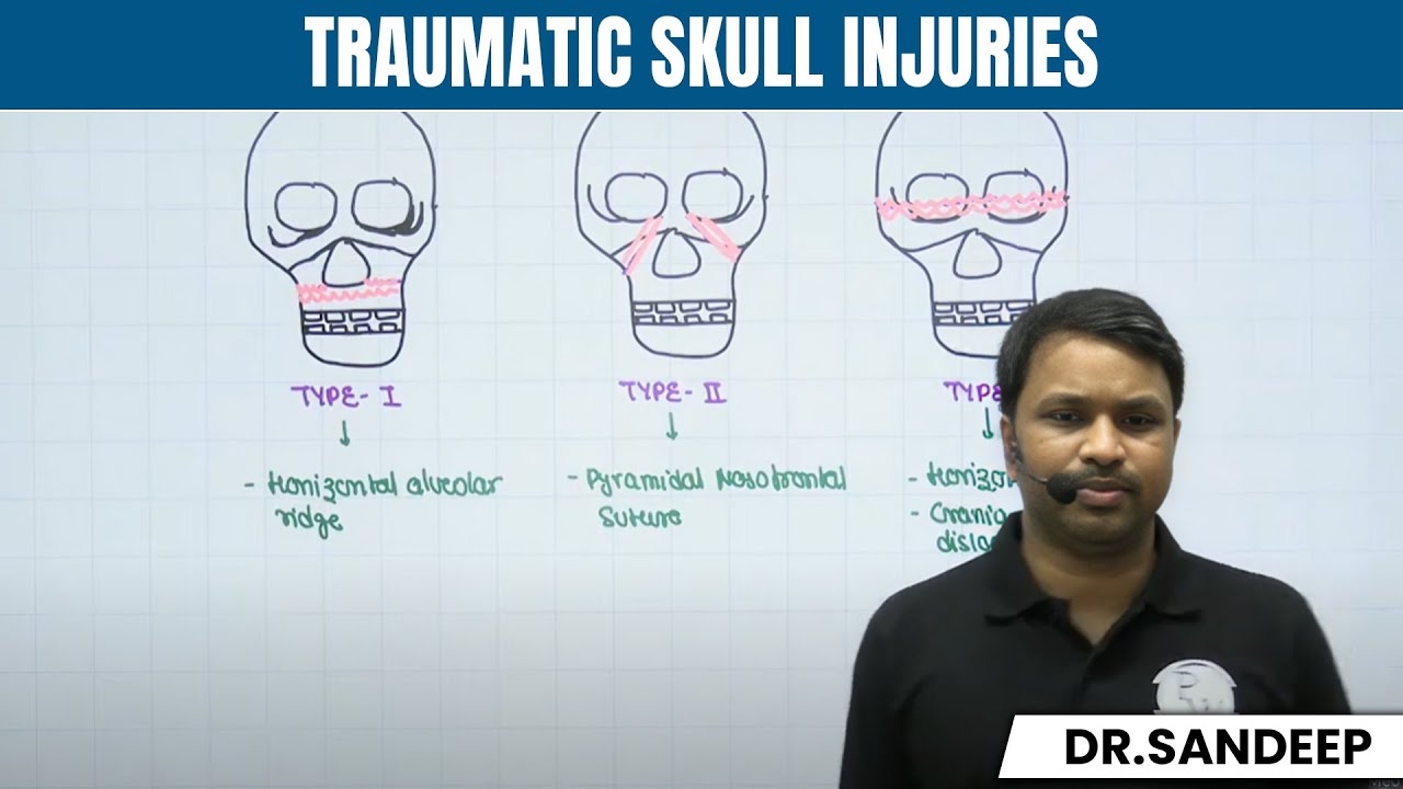 Traumatic Skull Injuries | Surgery | Bailey learned with Dr. Sandeep | PW MedEd