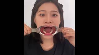 美女Mm小姐姐展示自己口腔情况牙齿喉咙扁桃体欣赏了解更多507871282