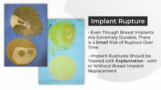 Not All Breast Explants Are Equal. Plastic Surgery Hot Topics with Rod J. Rohrich, MD