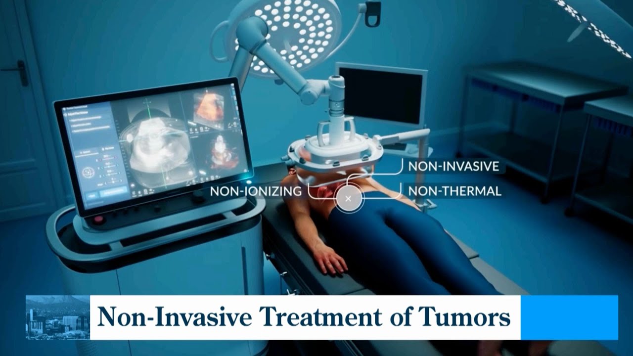 Histotripsy: A Patient's Journey with Non-Invasive Cancer Treatment