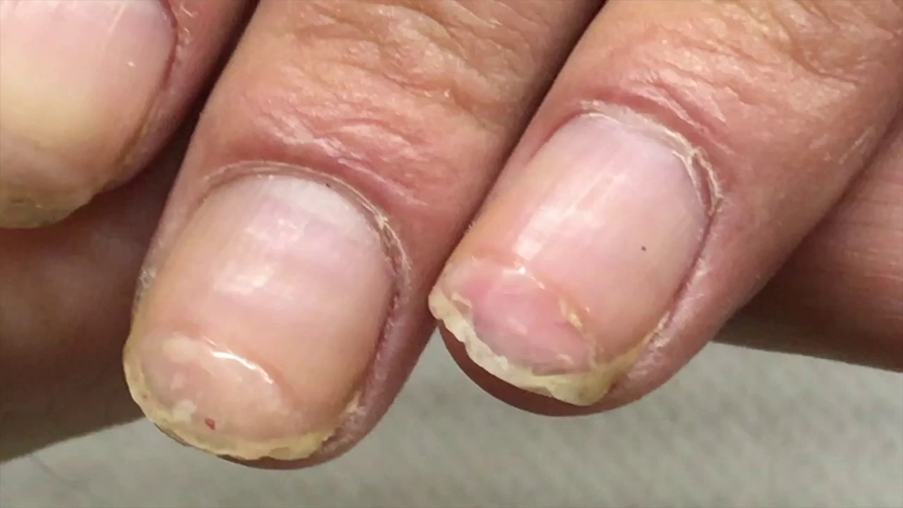  TRANSFORMATION Of HARDWORKER RUINED Nails DETAILED STEP BY STEP TUTORIAL YouTube