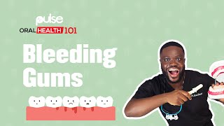 How to deal with Bleeding Gums | Pulse Oral Health 101 How to deal with Bleeding Gums | Pulse Oral Health 101