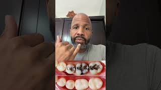 🚨 NETFLIX PULLED THIS ROOT CANAL DOCUMENTARY—BUT WHY