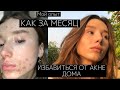 КАК ИЗБАВИТЬСЯ ОТ ПРЫЩЕЙ БЫСТРО?💕|ЛЕЧЕНИЕ АКНЕ|Чистая кожа 🤩Мой опыт Питание и Советы!