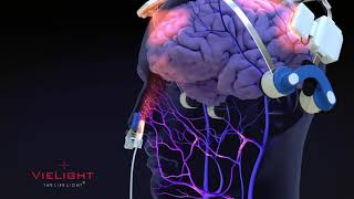Vielight Neuro Animation