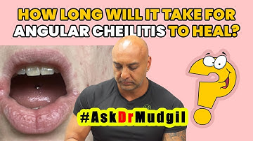 HOW LONG WILL IT TAKE FOR ANGULAR CHEILITIS TO HEAL?