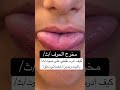 كيف ادرب طفلي على مخرج الحرف ث بالبيت وبدون اخصائي نطق تاخر نطق اخصائي نطق علي ابوورده اكسبلو 
