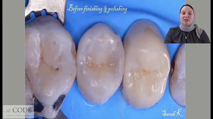 Finishing and Polishing Dr Sarah Ghattas