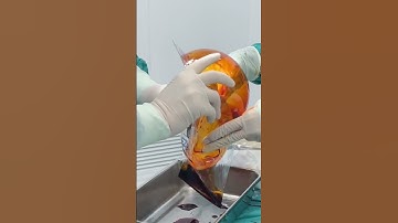 Túi ngực to quá thì đưa vào bằng cách nào? chị em vào xem ngay clip để biết đáp án nhé!