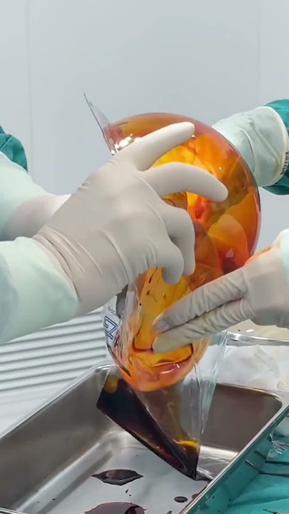 Túi ngực to quá thì đưa vào bằng cách nào? chị em vào xem ngay clip để biết đáp án nhé!