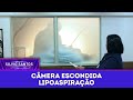 Lipoaspiração Câmeras Escondidas 05 10 25 