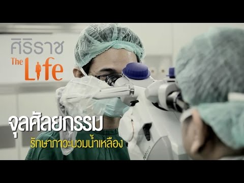 ศิริราช The Life [by Mahidol] ซีรีส์ มองโรคในแง่ดี ตอน จุลศัลยกรรม รักษาภาวะบวมน้ำเหลือง